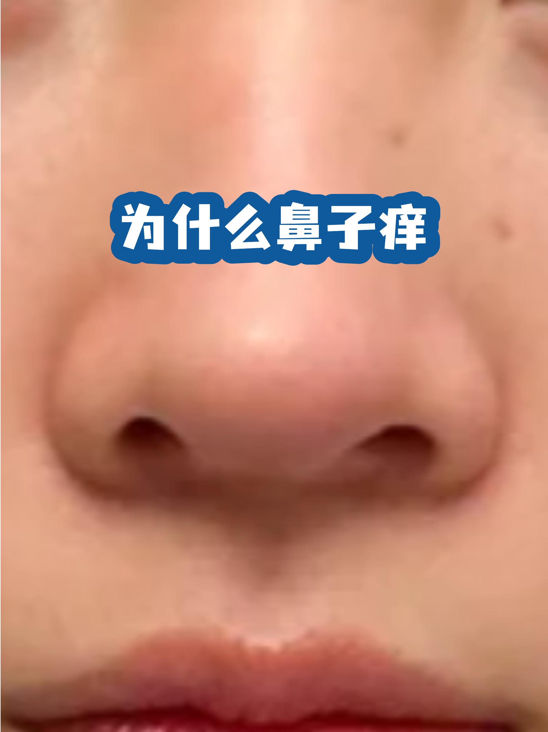 宠物鼻头发红 狗狗鼻头有点红